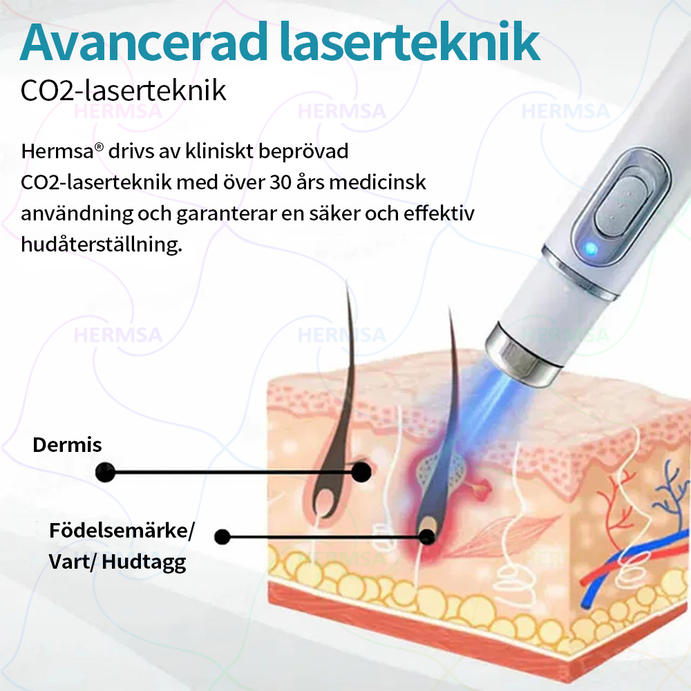 Hermsa® Non-invasive Laser Pen - Birthmark and Warts Removal(🔥Last day 80% ALE)