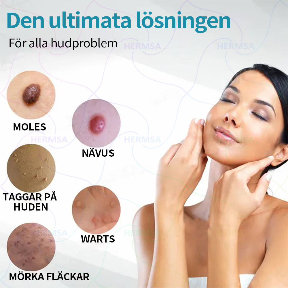 Hermsa® Non-invasive Laser Pen - Birthmark and Warts Removal(🔥Last day 80% ALE)